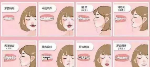 大名县医院牙齿矫正价格表：不同牙套材质价格差异及矫正周期详解